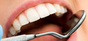 Entkalkungen der Zähne und Erosionen treten immer häufiger auf. Wir erklären Ihnen gern in einem persönlichem Gespräch die Vorteile der Zahnfüllung OHNE BOHREN